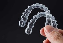 Positive Transformation with Franklin Square Invisalign: The Ultimate Guide to a Radiant Smile